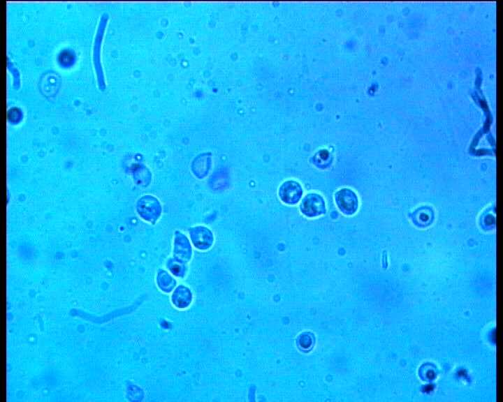 Hydropus atramentosus (Kalchbr.) Kotl. & Pouz.
